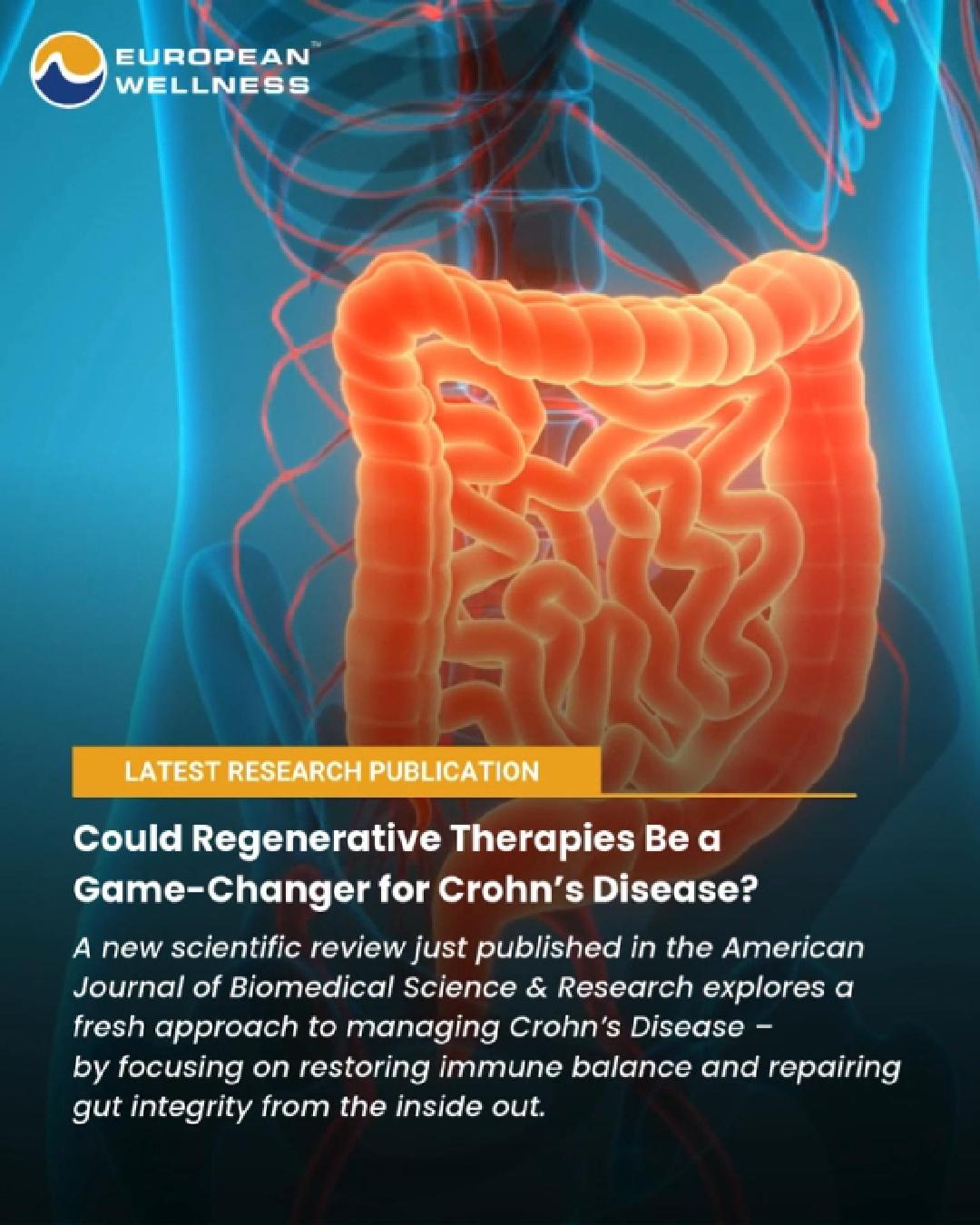 Could Regenerative Therapies Be a Game-Changer for Crohn’s Disease?