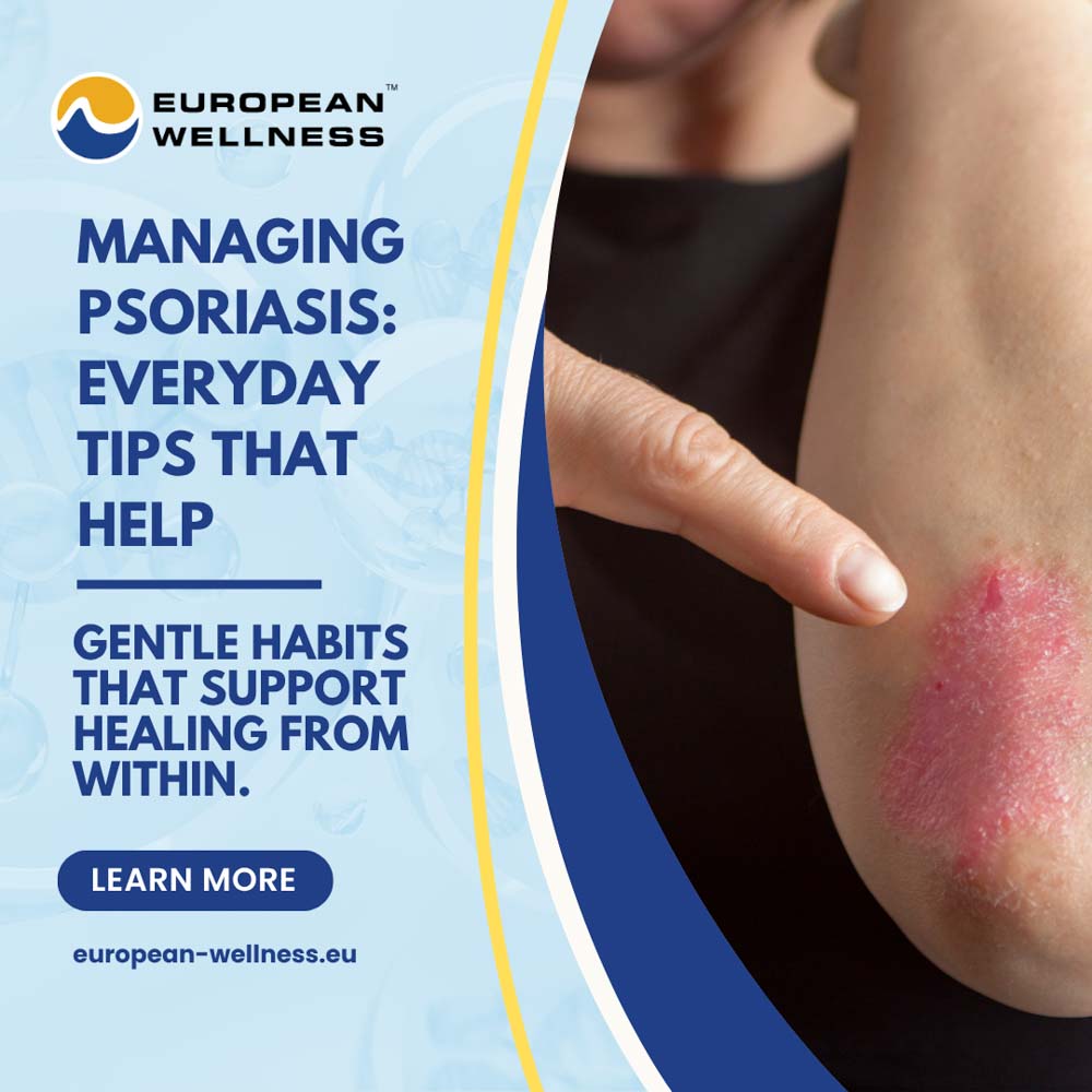 Managing Psoriasis