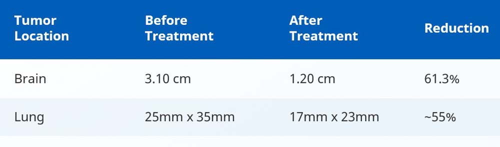Post-treatment scans result